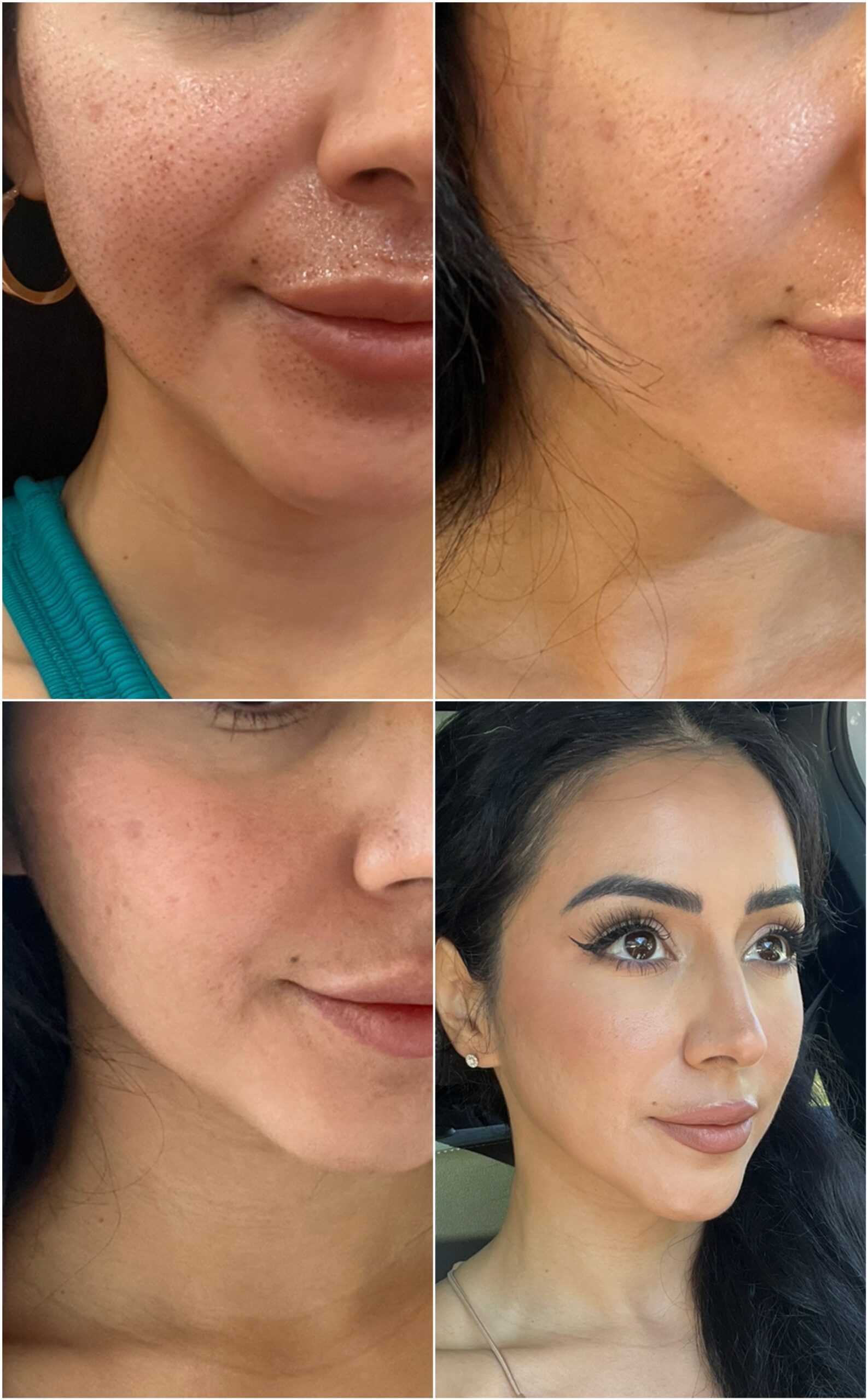 collage of healing skin